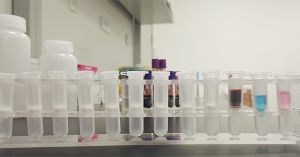 【佳学基因检测】肾小管酸中毒伴骨石症基因解码、基因检测的报告有人解读吗? 【佳学基因检测】肾小管酸中毒伴骨石症基因解码、基因检测的报告有人解读吗?