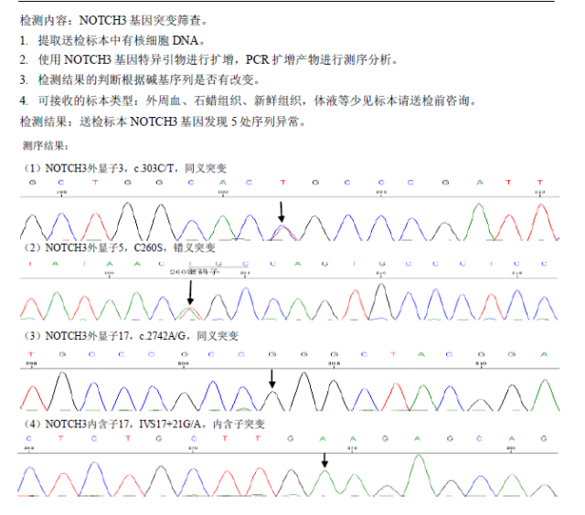 【佳学基因检测】常染色体显性遗传病合并皮质下梗死和白质脑病基因解码、基因检测 【佳学基因检测】常染色体显性遗传病合并皮质下梗死和白质脑病基因解码、基因检测