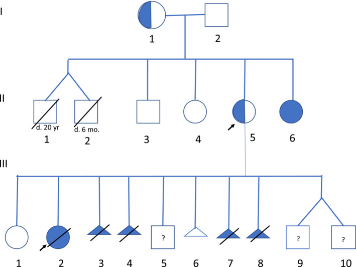 【佳学基因检测】Cornelia de Lange综合征阻断遗传可以吗? 【佳学基因检测】Cornelia de Lange综合征阻断遗传可以吗?