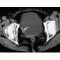【佳学基因检测