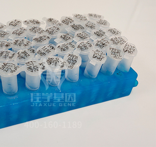 【佳学基因-基因检测】科学家成功精确定位糖尿病基因,根治糖尿病已不是梦想! 【佳学基因-基因检测】科学家成功精确定位糖尿病基因,根治糖尿病已不是梦想!