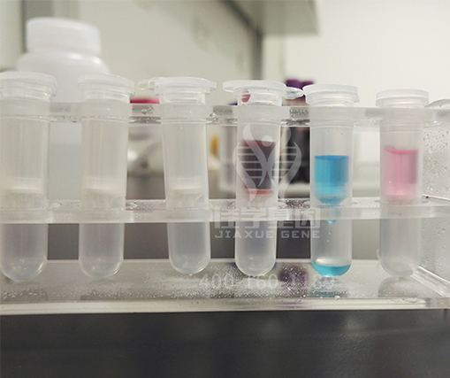 【佳学基因解码-基因检测】基因解码研究发现,老年痴呆症发病前15至20年大脑中就已存在迹象! 【佳学基因解码-基因检测】基因解码研究发现,老年痴呆症发病前15至20年大脑中就已存在迹象!