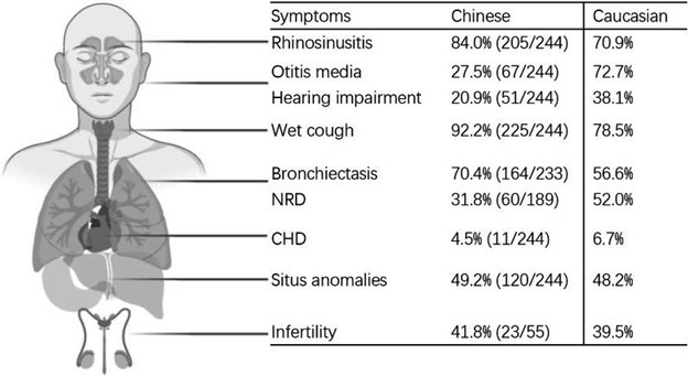 【佳学基因检测】原发性纤毛运动障碍临床表现及基因检测结果的变化 【佳学基因检测】原发性纤毛运动障碍临床表现及基因检测结果的变化