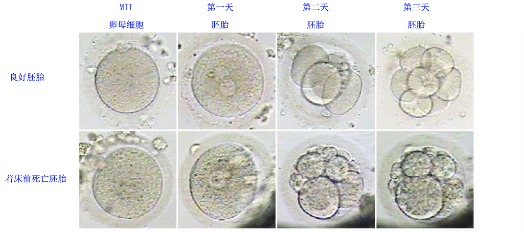 【送子观音基因检测】IVF、试管婴儿反复失败原来需要这样做！