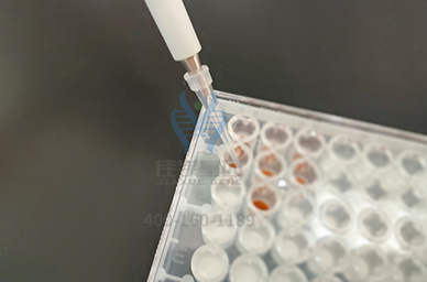 【佳学基因检测】看疾病风险评估报告前，需要谙熟于心的CRYGFP知识