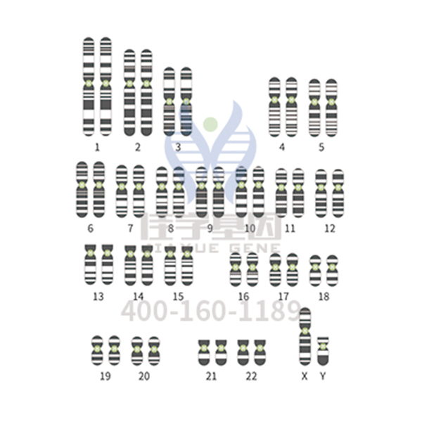 【佳学基因解码-基因检测】小心这种指甲半月牙异常,有可能是指甲髌骨综合征 【佳学基因解码-基因检测】小心这种指甲半月牙异常,有可能是指甲髌骨综合征