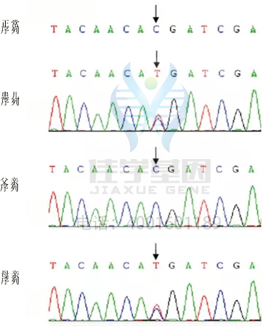 【基因检测基因解码案例】巴特综合症——佳学基因 【基因检测基因解码案例】巴特综合症——佳学基因