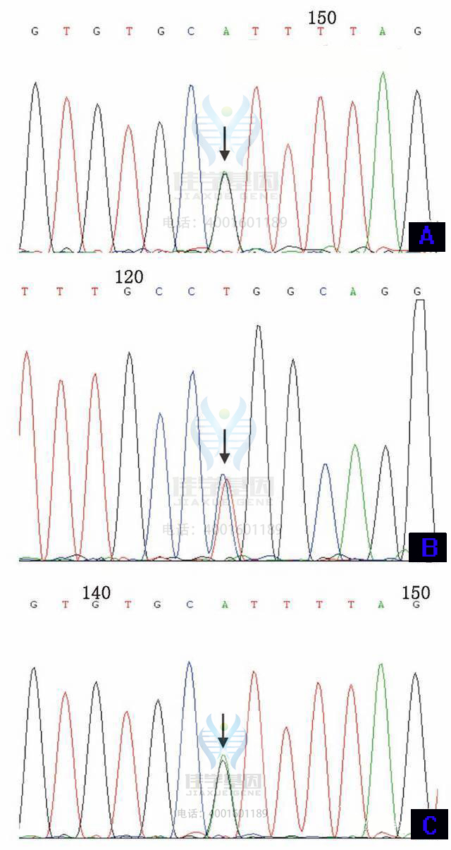 【基因检测基因解码案例】先天性红细胞生成异常性贫血——佳学基因 【基因检测基因解码案例】先天性红细胞生成异常性贫血——佳学基因