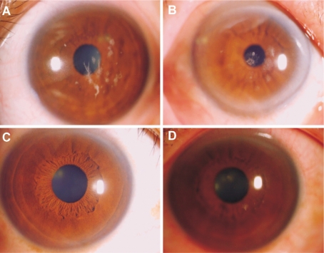 【佳学基因检测】染色体突变检测E2F2存在突变，如何理解？