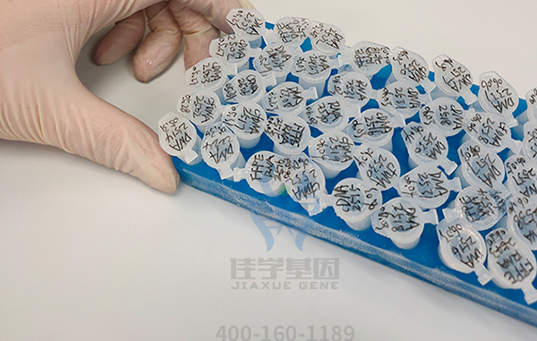 【佳学基因检测】安徽省亳州市基因检测诊所 【佳学基因检测】安徽省亳州市基因检测诊所