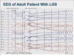 【佳学基因检测