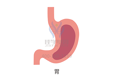 【佳学基因解码-基因检测】为避免家族性胃癌,美国一女子做了胃切除手术 【佳学基因解码-基因检测】为避免家族性胃癌,美国一女子做了胃切除手术