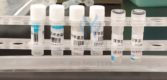 【佳学基因-基因检测】王女士腹痛反复,原来是甲状腺旁腺功能亢进引起的! 【佳学基因-基因检测】王女士腹痛反复,原来是甲状腺旁腺功能亢进引起的!